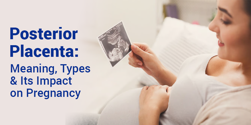 Posterior Placenta: Meaning, Types, and Its Impact on Pregnancy